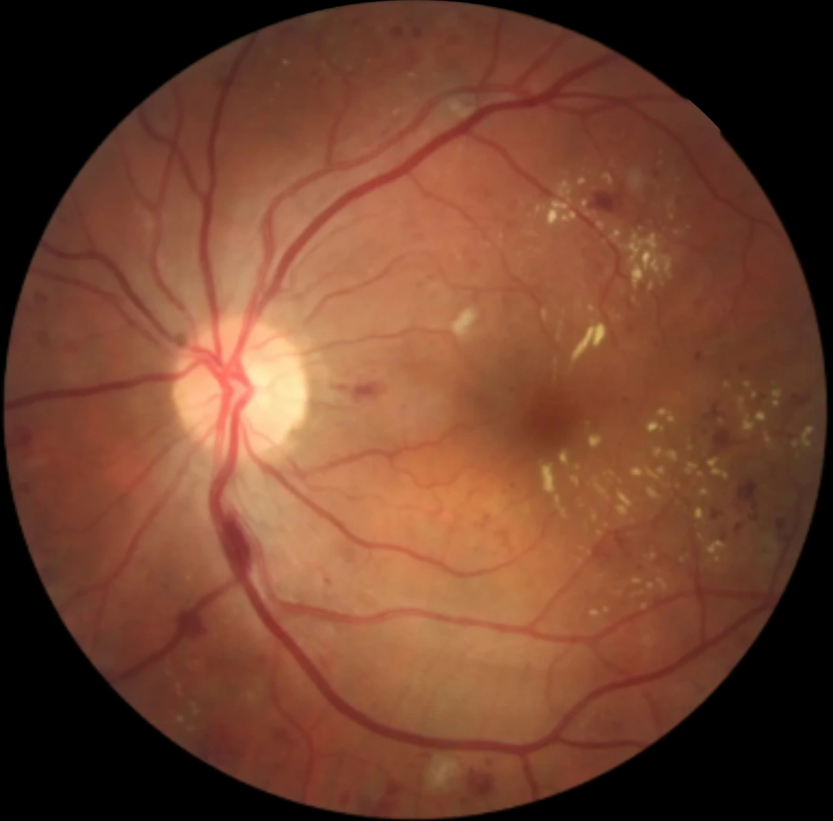 Original fundus image