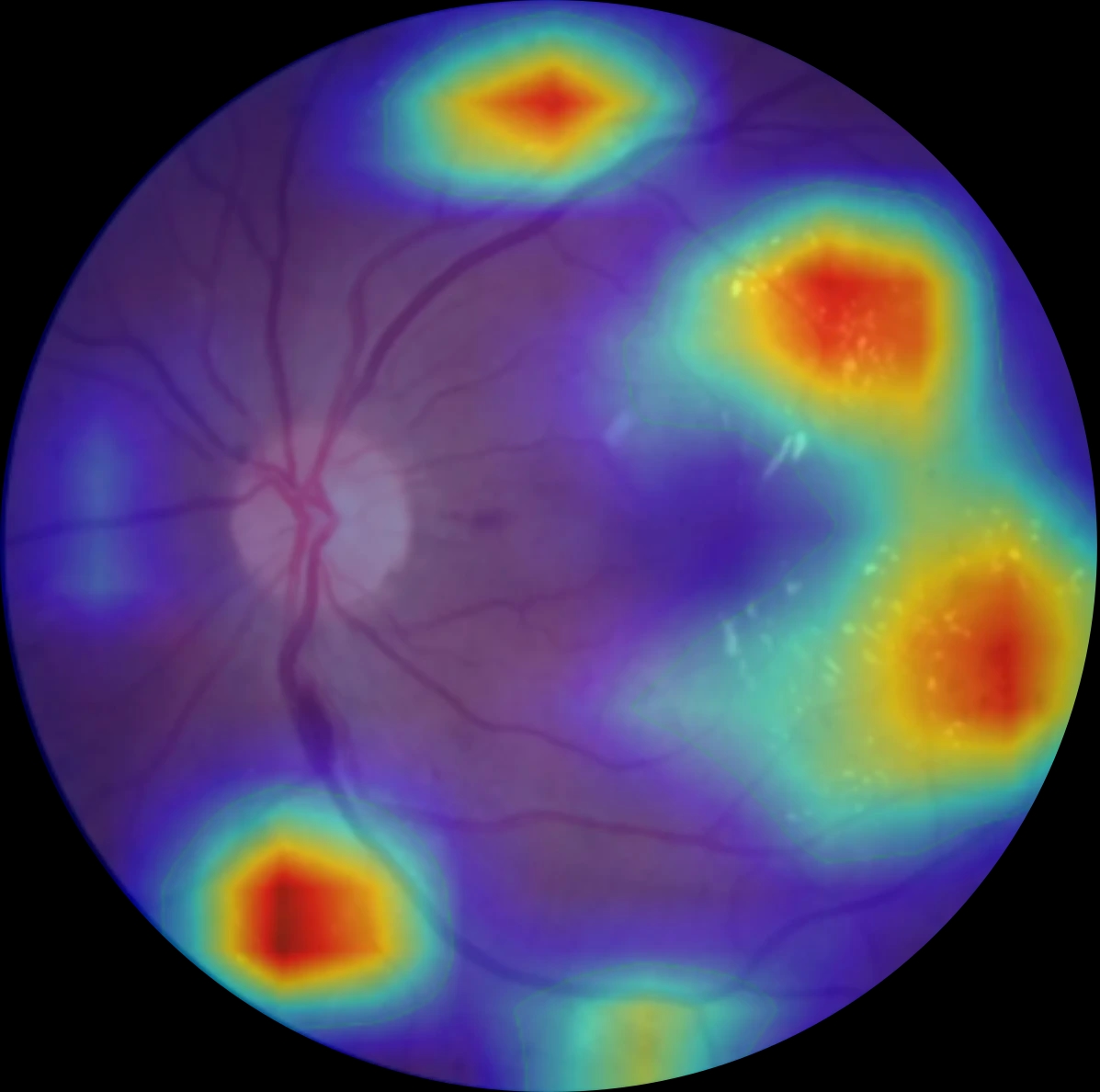 Explainable AI analysis of the fundus image
